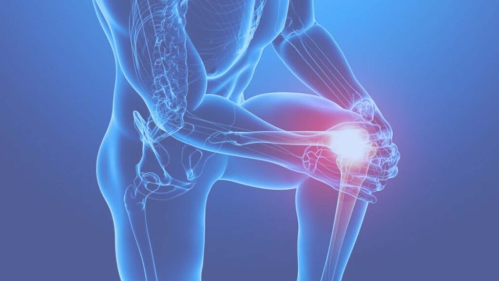 Lesione legamenti del ginocchio